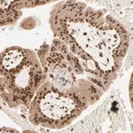 Merck Anti-MED15 antibody produced in rabbit