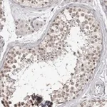 Merck Anti-SRCAP antibody produced in rabbit