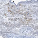 Merck Anti-ERVMER34-1 antibody produced in rabbit