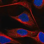 Merck Anti-DENND6A antibody produced in rabbit