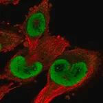 Merck Anti-TXNRD1 antibody produced in rabbit