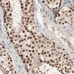 Merck Anti-SMARCD1 antibody produced in rabbit