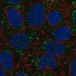 Merck Anti-DGKA antibody produced in rabbit