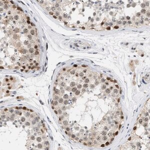 Merck Anti-ELAC2 antibody produced in rabbit