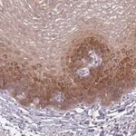 Merck Anti-KLC3 antibody produced in rabbit