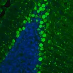 Merck Anti-BCAR1 antibody produced in rabbit