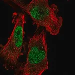 Merck Anti-SETDB1 antibody produced in rabbit