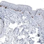 Merck Monoclonal Anti-TYRP1 antibody produced in mouse