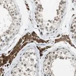 Merck Anti-NEK4 antibody produced in rabbit
