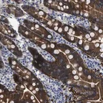 Merck Anti-CBR1 antibody produced in rabbit