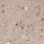 Merck Anti-MAGI2 antibody produced in rabbit