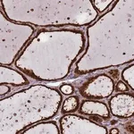 Merck Anti-SALL1 antibody produced in rabbit