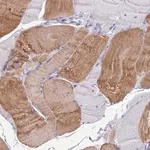 Merck Anti-KIAA0408 antibody produced in rabbit