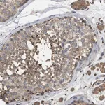 Merck Anti-RNF216 antibody produced in rabbit