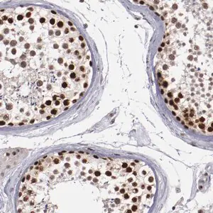 Merck Anti-DDX24 antibody produced in rabbit