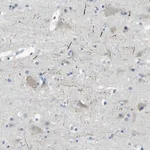 Merck Anti-SORCS1 antibody produced in rabbit