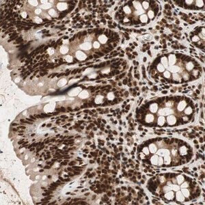 Merck Anti-NCBP3 antibody produced in rabbit