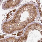 Merck Anti-CYP20A1 antibody produced in rabbit