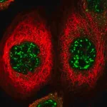 Merck Anti-FOXO4 antibody produced in rabbit