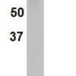 Merck Anti-SREBP1 Antibody, clone 2121