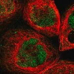 Merck Anti-UBN2 antibody produced in rabbit