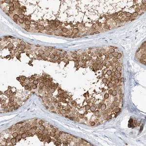 Merck Anti-NAA11 antibody produced in rabbit