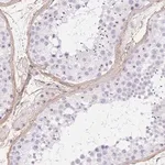 Merck Anti-PDZD2 antibody produced in rabbit