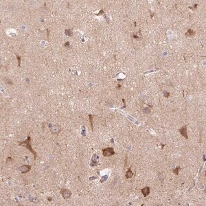 Merck Anti-LRRTM1 antibody produced in rabbit