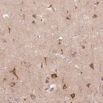 Merck Anti-LRRTM1 antibody produced in rabbit