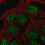Merck Anti-ST6GALNAC3 antibody produced in rabbit