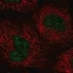 Merck Anti-NABP1 antibody produced in rabbit