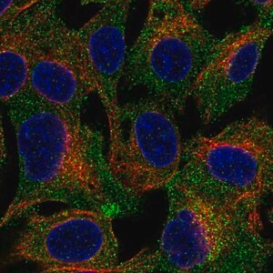 Merck Anti-TRPC4AP antibody produced in rabbit
