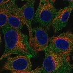 Merck Anti-TRPC4AP antibody produced in rabbit