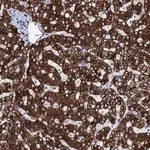 Merck Anti-GYS2 antibody produced in rabbit