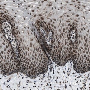 Merck Anti-MORC3 antibody produced in rabbit