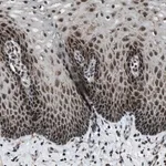 Merck Anti-MORC3 antibody produced in rabbit