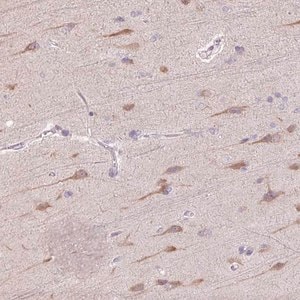 Merck Anti-TMEM100 antibody produced in rabbit