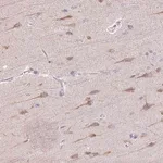 Merck Anti-TMEM100 antibody produced in rabbit