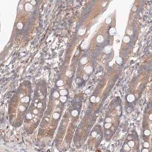Merck Anti-PGGT1B antibody produced in rabbit