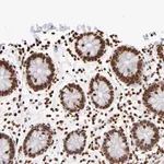 Merck Anti-ZCCHC16 antibody produced in rabbit