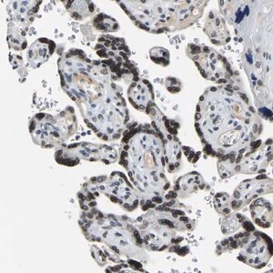 Merck Anti-RANBP2 antibody produced in rabbit