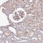Merck Anti-COL8A2 antibody produced in rabbit
