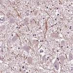 Merck Anti-CNGA3 antibody produced in rabbit