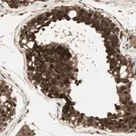 Merck Anti-CSNK2B antibody produced in rabbit