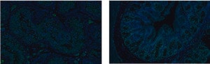Merck Anti-SOX17