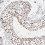 Merck Anti-RECQL4 antibody produced in rabbit