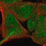 Merck Anti-NFE2L1 antibody produced in rabbit