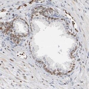 Merck Anti-PRKAG2 antibody produced in rabbit