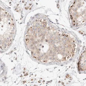 Merck Anti-SLC25A26 antibody produced in rabbit