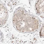 Merck Anti-SLC25A26 antibody produced in rabbit